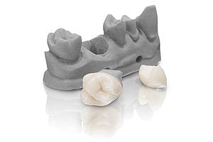 VarseoSmile Crown Plus