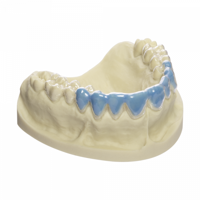 Soft (Bleaching) Trays