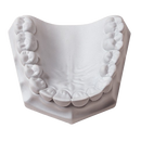 Orthodontic Stone